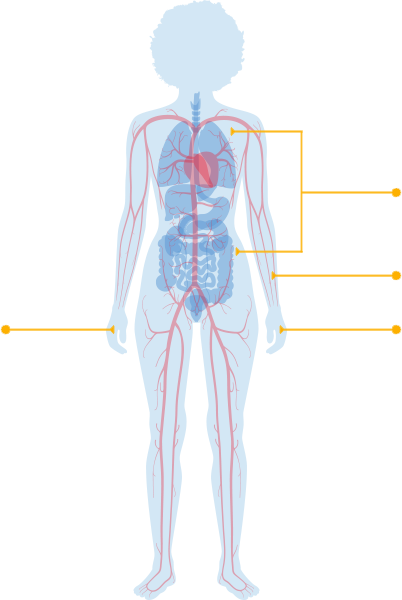 Systemic sclerosis and localized scleroderma effects